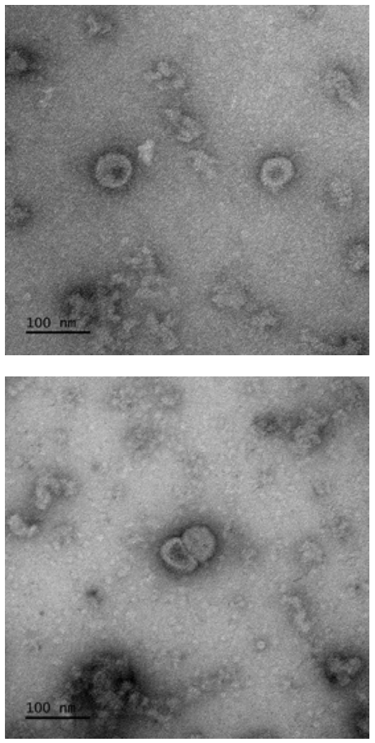 코로나19 바이러스항원(Spike)으로 구성된 바이러스유사체 투과전자현미경 (TEM) 이미지 [국립보건연구원 제공]